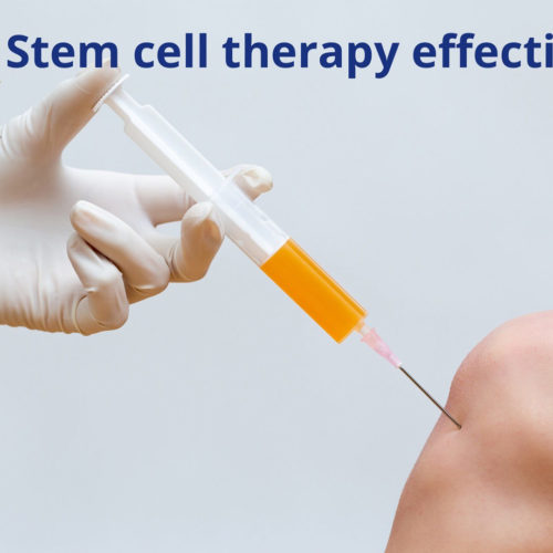 How Effective Is Stem Cell Therapy?