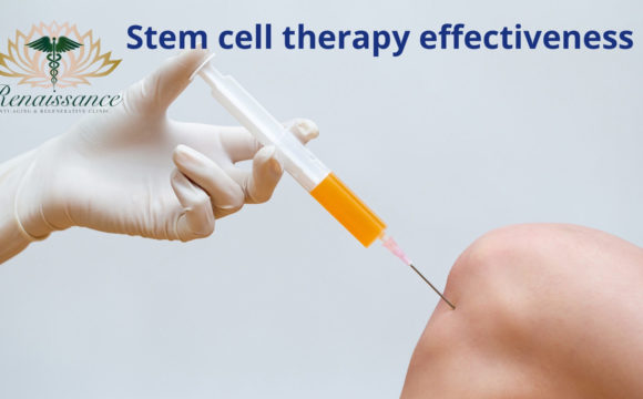 ¿Qué tan efectiva es la terapia con células madre?