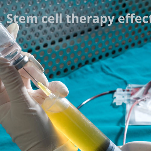 Stem cell therapy success