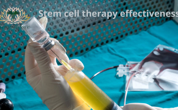 Éxito de la terapia con células madre